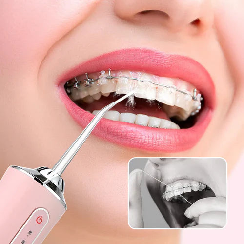 Water Flosser Oral Irrigator Mouth Spa (4 Nozzle) – GLORYSMILE®