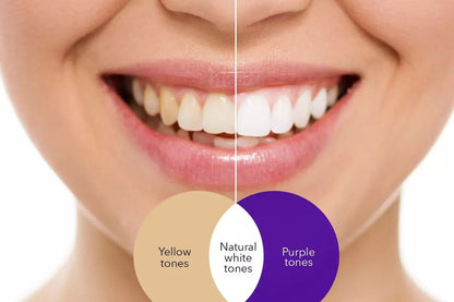 Remove Yellow Tones and Stains from teeth