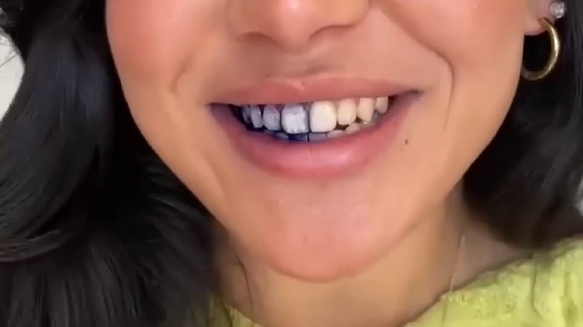 Load video: V34 Colour Corrector Teeth Whitening Purple Serum